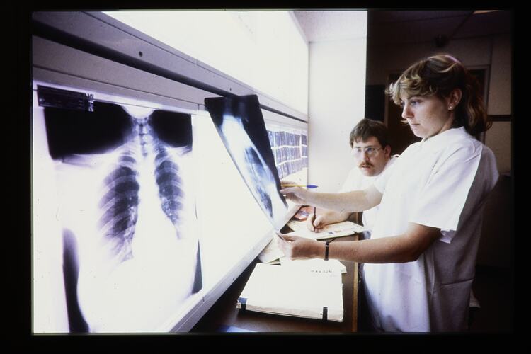 Slide - Kodak, Man & Woman Examining X-Rays, circa 1960s