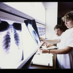 Slide - Kodak, Man & Woman Examining X-Rays, circa 1980s