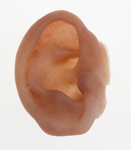 Prosthesis - Outer Ear, Right