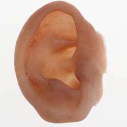 Prosthesis - Outer Ear, Right