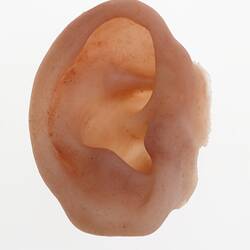 Prosthesis - Outer Ear, Right