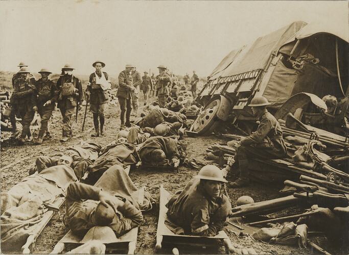 Wounded soldiers on stretchers and walking along road.