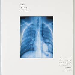 Leaflet - Kodak (Australasia) Pty Ltd, Amber Thoracic Radiograph, circa 1990s
