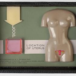 Model - Female Reproductive System, 1970s