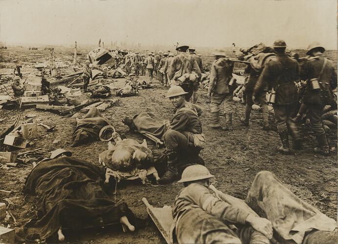 Soldiers wounded on stretchers and walking along road.