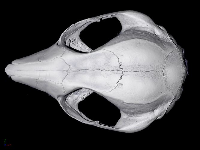 CT scan of skull