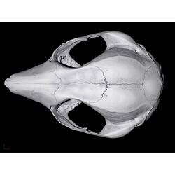 CT scan of skull