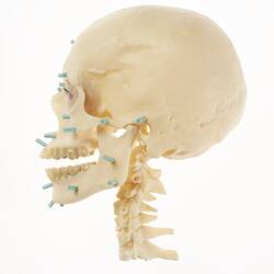 Model of human skull with blue pegs inserted. Left profile.