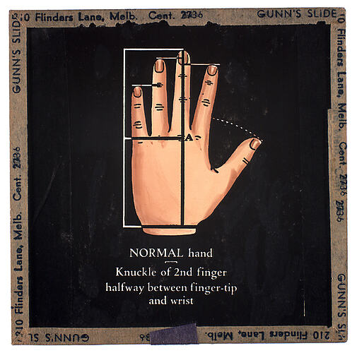 Lantern Slide - Universal Opportunity League, 'Normal Hand'