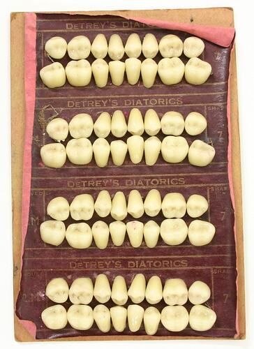 Set of artificial teeth made of porcelain