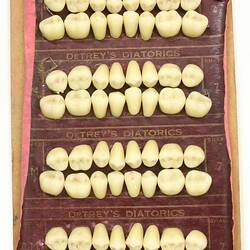 Artificial Teeth - Porcelain Cuspid & Molar, Detrey's Diatorics, circa 1925