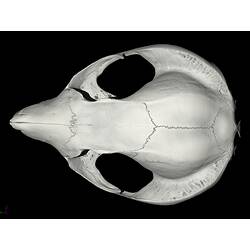 CT scan of skull