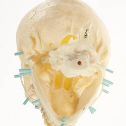 Underside view of model of human skull with blue pegs inserted.