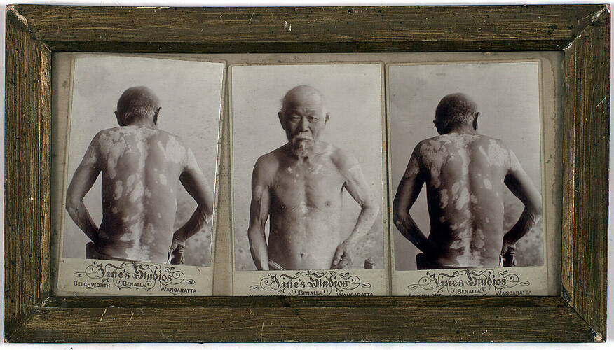 Three images of an elderly man.