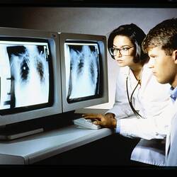 Slide - Kodak, Man & Woman Examining X-Rays, circa 1990s