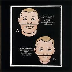 Phrenology lantern slide depicting the comparison between an overdeveloped and underdeveloped 'vitality' section of face.