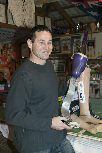 Man posing with prosthetic lower leg.