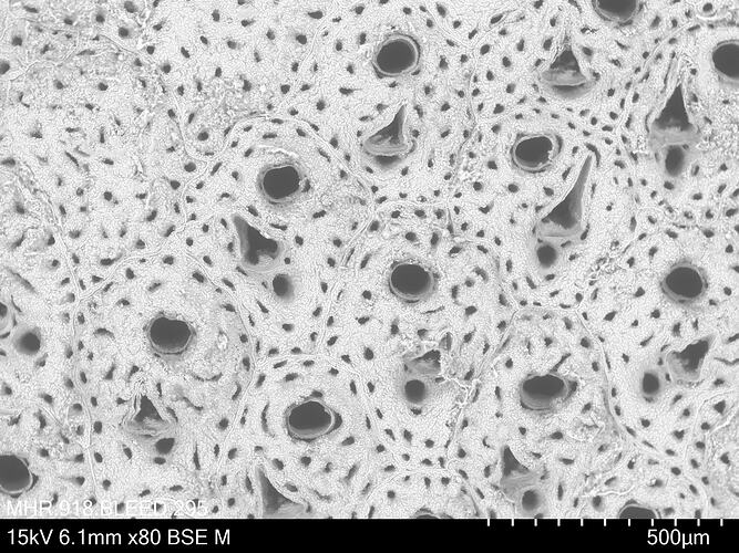 Microscopic view of bryozoan.