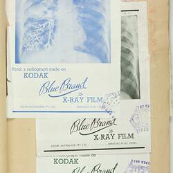 Scrapbook - Kodak Australasia Pty Ltd, Advertising Clippings, 'Medical and Dental/Visual Education', Abbotsford, 1955-1959