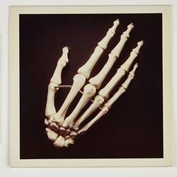 Photograph - Eastman Kodak, Hand Skeleton Model, circa 1970s
