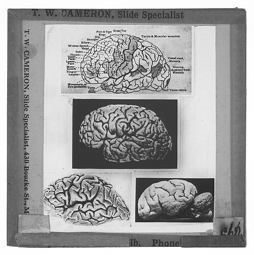 Lantern Slide - Universal Opportunity League, Four Views of Brains