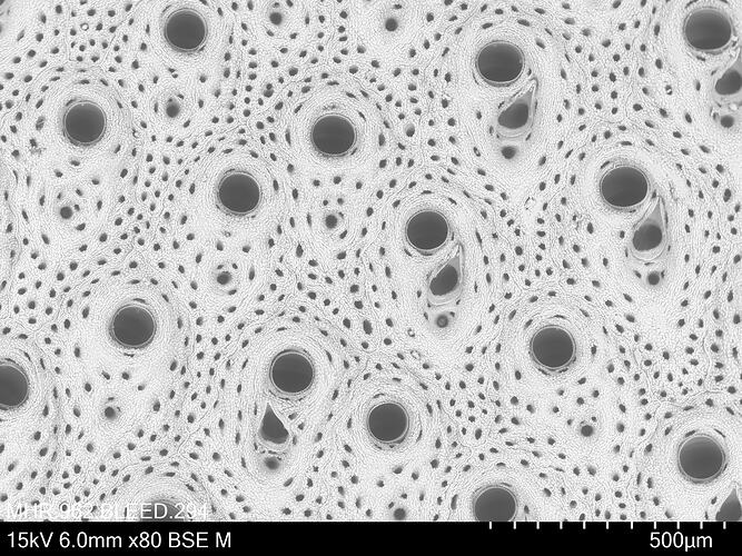 Microscopic view of bryozoan.