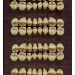 Artificial Teeth - Porcelain Cuspid & Molar, DeTrey's Diatorics, circa 1925