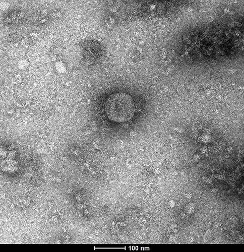 Digital Image - First Australian images taken of SARS-CoV-2, Doherty Insitute, Parkville, 31 Jan 2020