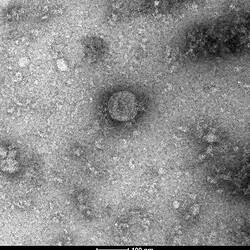 Digital Image - First Australian images taken of SARS-CoV-2, Doherty Institute, Parkville, 31 Jan 2020
