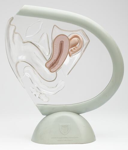 Model with clear plastic encasing scaled-down female reproductive organs, mounted on a stand.