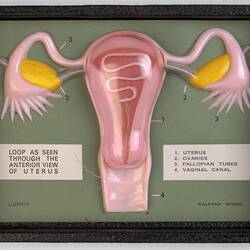 Model - Female Reproductive System, 1970s
