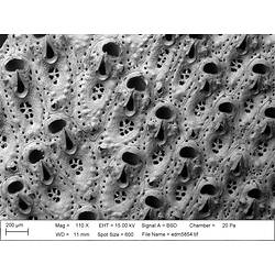 Microscopic view of bryozoan.