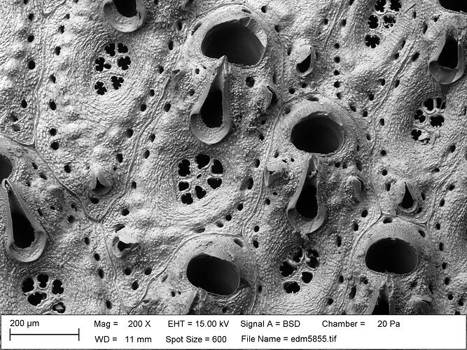 Microscopic view of bryozoan.