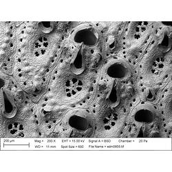 Microscopic view of bryozoan.