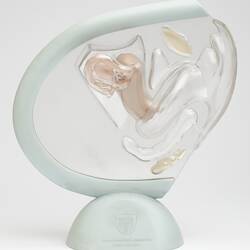 Model with clear plastic encasing scaled-down female reproductive organs, mounted on a stand.