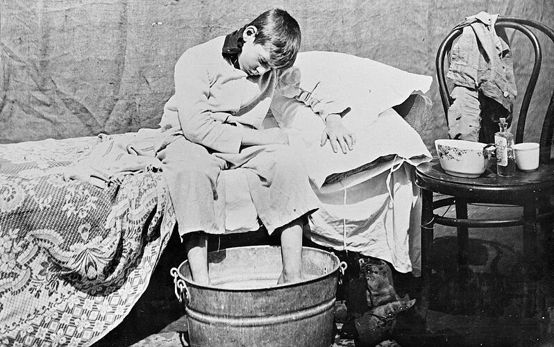 An unwell boy, seated on his bed with his feet in a washtub.