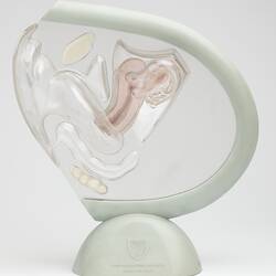 Model with clear plastic encasing scaled-down female reproductive organs, mounted on a stand.