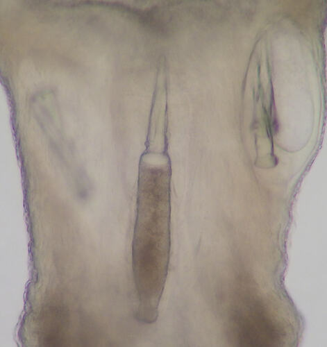 Stylet inside nemertean worm.