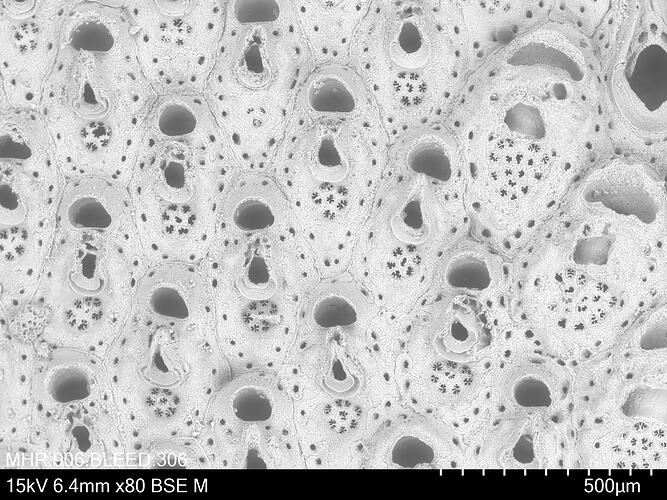 Microscopic view of bryozoan.