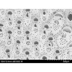 Microscopic view of bryozoan.