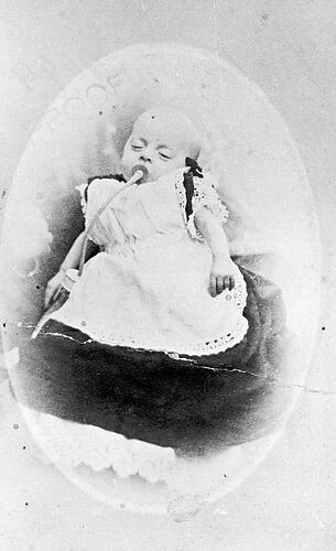 [A baby with a long tube feeding bottle, 1890s. The baby could feed while unattended but milk collected in the tube, soured and could poison the child.]