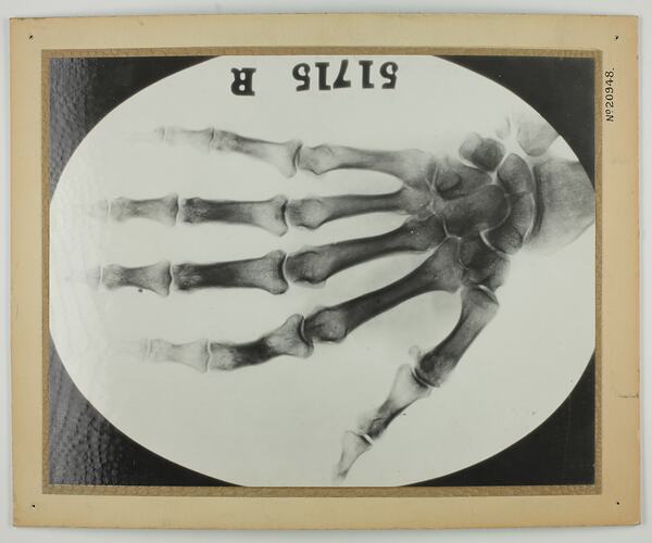 Picturegram - X-Ray of a Human Hand, Post Master General's Department, circa 1938