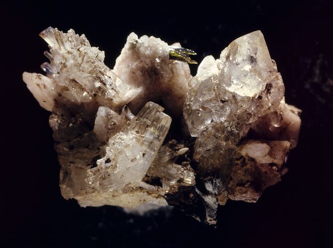 Epididymite. [M 38899]