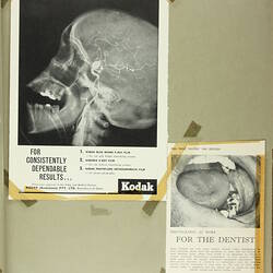 Scrapbook - Kodak Australasia Pty Ltd, Advertising Clippings, 'X-ray (Medical)', Coburg, 1961-1975