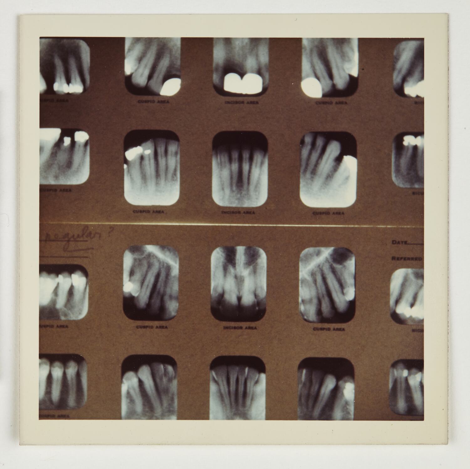 Photograph Eastman Kodak, Dental XRays, circa 1970s