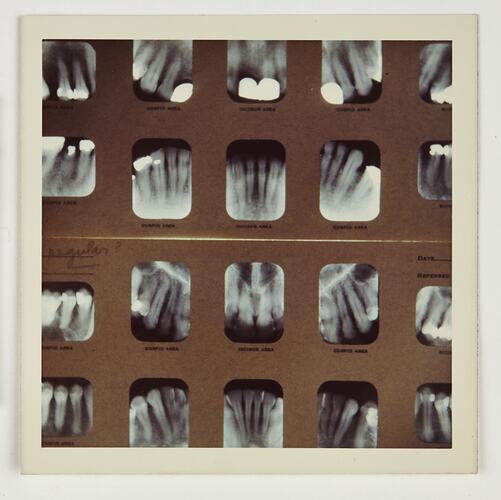 Section of a page of mounted dental x-rays.