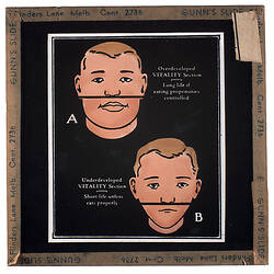 Lantern Slide - Universal Opportunity League, Overdeveloped and Underdeveloped Vitality