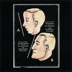Phrenology lantern slide depicting the comparison between a receding and protruding facial-profile.