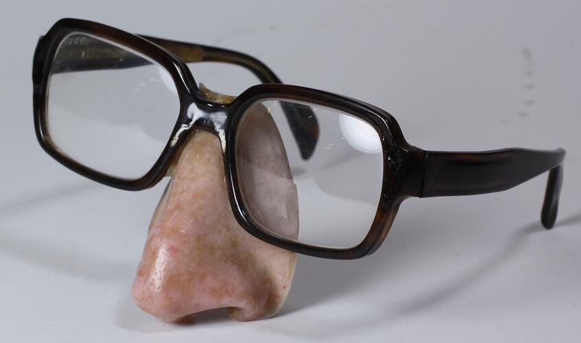 Artificial Nose Prosthesis - Michael Greve, Attached to Spectacles, 1991