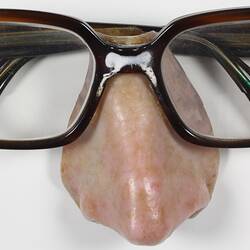 Artificial Nose Prosthesis - Michael Greve, Attached to Spectacles, 1991